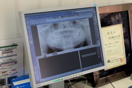 デジタルレントゲン フィルムを使わず、デジタル画像処理により、的確な診断と治療に利用します。